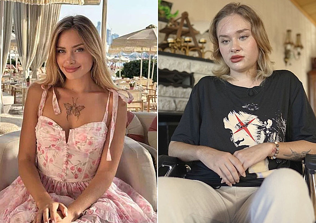 Modelka utrpěla vážná zranění a skončila na vozíku. Neví, co se stalo