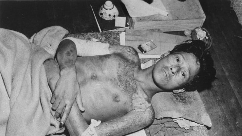 Muž, který přežil atomovou bombu v Nagasaki: Byla to noční můra. Lidem visela kůže z rukou