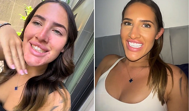 Žena chtěla dokonalý chrup. Dnes ho má a září do dálky