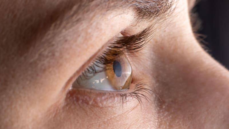 Vady vs. nemoci očí: Jaký je rozdíl? Na zdravý zrak brýle nestačí, rozhodují návyky i geny