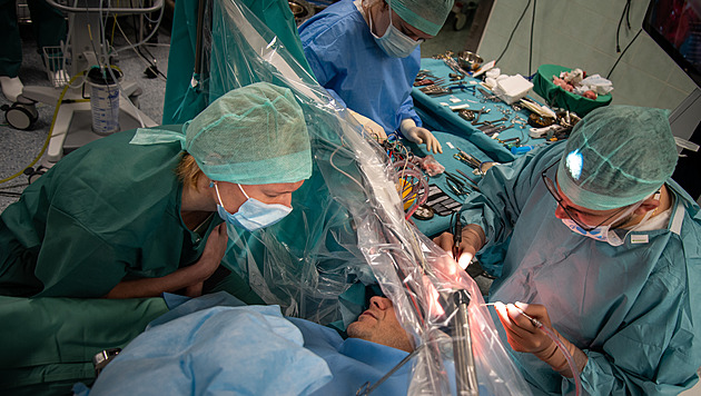 Operovat, nebo jen pozorovat? Novinka odhalí rizikovost mozkové výdutě